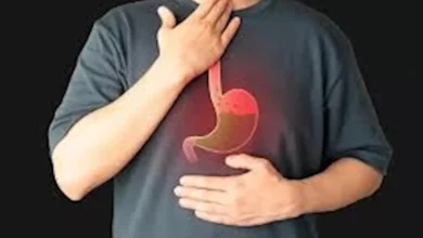 أعراض ارتجاع المريء.. استشاري يكشف طرق العلاج